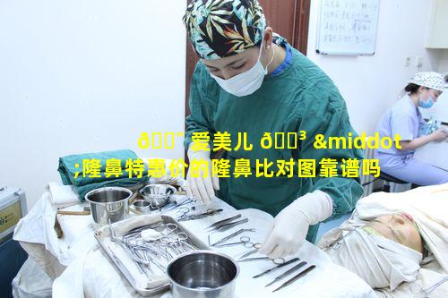 🐯 爱美儿 🌳 ·隆鼻特惠价的隆鼻比对图靠谱吗